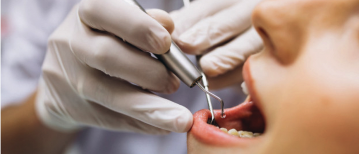 Root Canal Therapy - Park Street Family Dental Root Canal Therapy - Park Street Family Dental