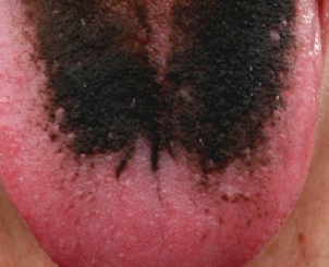 mifani